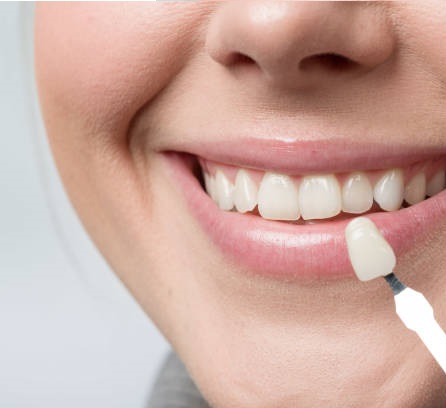 chica compara carilla dental con diente natural